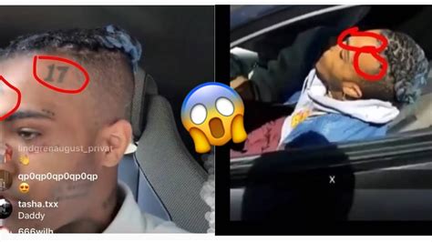 xxxtentacions autopsy photo|XXXTentacion death: Chilling last picture shows rapper in。